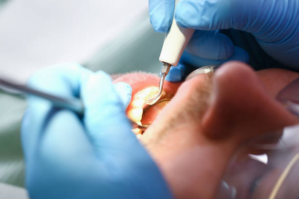 Best Cracked Tooth Emergency Dentist  in Flowery Branch, GA